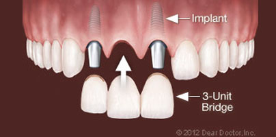 Dentist in Uncasville