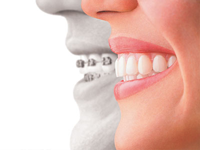 Affinity Dental Center | Dentures, Pediatric Dentistry and Cosmetic Dentistry