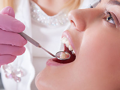 Affinity Dental Center | Root Canals, Dental Bridges and Dental Fillings